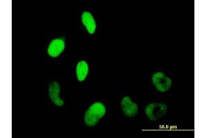 Immunofluorescence of purified MaxPab antibody to WHSC2 on HeLa cell. (WHSC2 Antikörper  (AA 1-528))