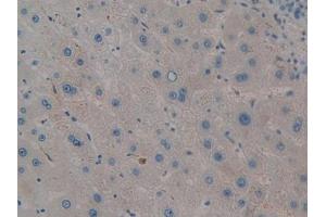 DAB staining on IHC-P; Samples: Human Liver Tissue (PIM2 Antikörper  (AA 82-291))