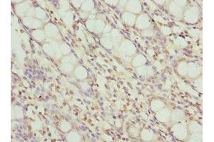 Immunohistochemistry of paraffin-embedded human colon tissue using ABIN7174024 at dilution of 1:100 (FRK Antikörper  (AA 1-220))