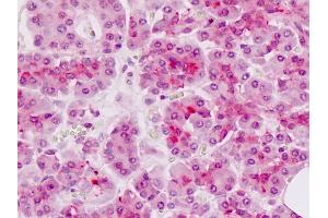 Immunohistochemistry (IHC) image for anti-Alveolar Soft Part Sarcoma Chromosome Region, Candidate 1 (ASPSCR1) (AA 392-418) antibody (ABIN1804342)