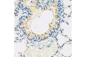 Immunohistochemistry of paraffin-embedded mouse lung using ABCF2 antibody (ABIN5972445) at dilution of 1/100 (40x lens). (ABCF2 Antikörper)