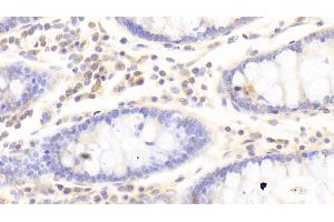 Immunohistochemistry (IHC) image for anti-Heparanase (HPSE) (AA 34-115) antibody (ABIN7438010)