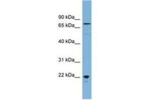Image no. 1 for anti-Membrane Protein, Palmitoylated 5 (MAGUK P55 Subfamily Member 5) (MPP5) (AA 575-624) antibody (ABIN6742119) (MPP5 Antikörper  (AA 575-624))