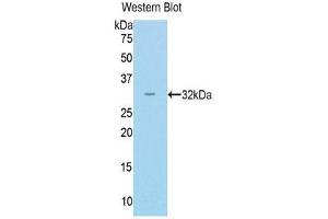 Western Blotting (WB) image for anti-Myosin (AA 1069-1331) antibody (ABIN1859923) (Myosin Antikörper  (AA 1069-1331))