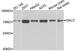 Western blot analysis of extracts of various cell lines, using GALC antibody (ABIN4903732) at 1:1000 dilution. (GALC Antikörper)