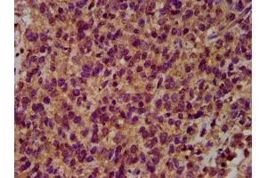 Immunohistochemistry (IHC) image for anti-HECT, C2 and WW Domain Containing E3 Ubiquitin Protein Ligase 2 (HECW2) (AA 495-641) antibody (ABIN7151037)