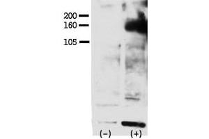 Image no. 1 for anti-V-Erb-A erythroblastic Leukemia Viral Oncogene Homolog 4 (Avian) (ERBB4) (pTyr1162) antibody (ABIN358139) (ERBB4 Antikörper  (pTyr1162))