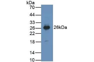 Detection of PTGDS in Human Urine using Monoclonal Antibody to Prostaglandin-H2 D-isomerase (PTGDS) (PTGDS Antikörper  (AA 32-190))