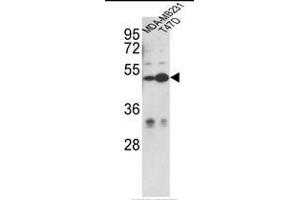 Western blot analysis of CEP55 Antibody (N-term) in MDA-MB231, T47D cell line lysates (35ug/lane). (CEP55 Antikörper  (N-Term))