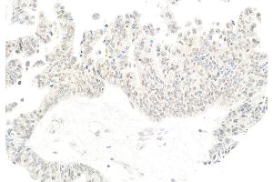 anti-Protein-L-Isoaspartate (D-Aspartate) O-Methyltransferase (PCMT1) (AA 150-200) antibody
