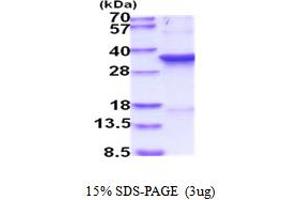 SDS-PAGE (SDS) image for Cyclin-Dependent Kinase 1 (CDK1) (AA 1-297) protein (His tag) (ABIN5854138) (CDK1 Protein (AA 1-297) (His tag))