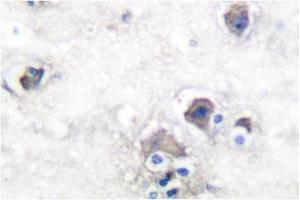 Image no. 2 for anti-Peripherin (PRPH) antibody (ABIN271783) (Peripherin Antikörper)