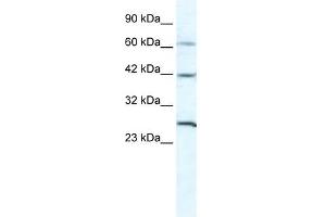 GJC1 antibody used at 5 ug/ml to detect target protein. (GJC1 Antikörper  (N-Term))