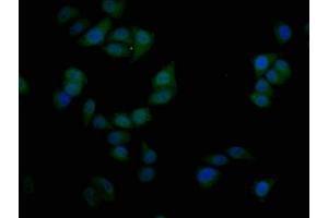 Immunofluorescence staining of Hela cells with ABIN7169724 at 1:50, counter-stained with DAPI. (SIM1 Antikörper  (AA 347-434))
