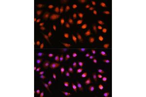 Immunofluorescence analysis of L929 cells using // antibody (ABIN7265520) at dilution of 1:100. (AKT 1/2/3 Antikörper)