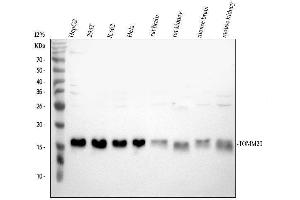 Western blot analysis of TOMM20 using anti-TOMM20 antibody (ABIN7600883). (TOMM20 Antikörper  (AA 25-145))