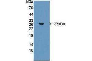 Detection of Recombinant SNAP23, Mouse using Polyclonal Antibody to Synaptosomal Associated Protein 23 kDa (SNAP23) (SNAP23 Antikörper  (AA 1-210))
