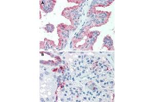 Immunohistochemical staining of human prostate (A) and human kidney (B) with SLC39A14 polyclonal antibody . (SLC39A14 Antikörper  (Internal Region))