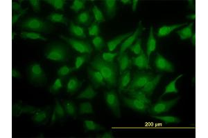 Immunofluorescence of monoclonal antibody to YBX1 on HeLa cell. (YBX1 Antikörper  (AA 51-139))