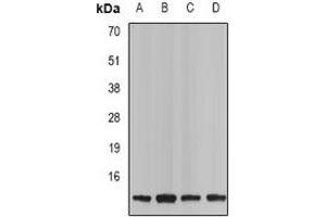 Western blot analysis of Neurokinin B expression in Jurkat (A), mouse spleen (B), rat kindney (C), rat brain (D) whole cell lysates. (Tachykinin 3 Antikörper)