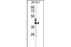 Western blot analysis of KRT35 Antibody (C-term) (ABIN651184 and ABIN2840116) in ZR-75-1 cell line lysates (35 μg/lane). (Keratin 35 Antikörper  (C-Term))