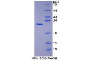 SDS-PAGE (SDS) image for Gastrokine 2 (GKN2) (AA 21-184) protein (His tag) (ABIN1170517) (Gastrokine 2 Protein (GKN2) (AA 21-184) (His tag))