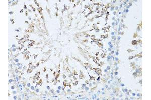 Immunohistochemistry of paraffin-embedded rat testis using TEFM antibody (ABIN5974873) at dilution of 1/100 (40x lens). (TEFM Antikörper)