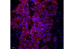 Immunofluorescence of paraffin embedded human colon using Lat (ABIN7074502) at dilution of 1: 2100 (400x lens) (LAT Antikörper)