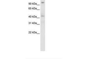 Image no. 3 for anti-Pogo Transposable Element with ZNF Domain (POGZ) (N-Term) antibody (ABIN203011)