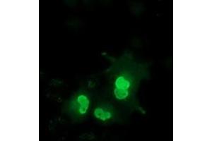 Anti-EPM2AIP1 mouse monoclonal antibody (ABIN2452999) immunofluorescent staining of COS7 cells transiently transfected by pCMV6-ENTRY EPM2AIP1 (RC209239). (EPM2AIP1 Antikörper)