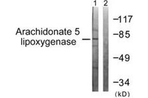 Western blot analysis of extracts from HuvEc cells, using Arachidonate 5 Lipoxygenase (Ab-271) Antibody. (ALOX5 Antikörper  (AA 246-295))