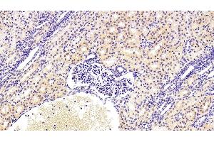 Detection of KMO in Human Kidney Tissue using Polyclonal Antibody to Kynurenine-3-Monooxygenase (KMO) (KMO Antikörper  (AA 1-374))