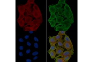 ABIN6257093 and ABIN6273472 staining Hela cells(30 min of UV treatment) by IF/ICC. (CX3CR1 Antikörper  (N-Term))