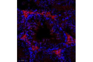 Immunofluorescence of paraffin embedded mouse testis using Cep78 (ABIN7073432) at dilution of 1:400 (300x lens) (CEP78 Antikörper)