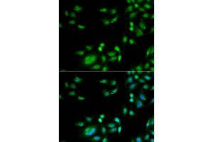 Immunofluorescence analysis of A549 cells using INTS10 antibody. (INTS10 Antikörper)