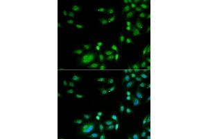 Immunofluorescence analysis of A549 cells using INTS10 antibody. (INTS10 Antikörper)