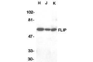 Western blot analysis of FLIP in HeLa (H), Jurkat (J), and K562 (K) whole cell lysate with AP30342PU-N FLIP antibody at 1/1000 dilution. (FLIP Antikörper  (C-Term))