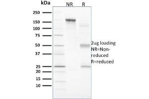 SDS-PAGE Analysis Purified Vinculin Mouse Monoclonal Antibody (VCL/2573). (Vinculin Antikörper  (AA 174-322))