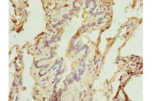 Immunohistochemistry of paraffin-embedded human lung tissue using ABIN7171242 at dilution of 1:100 (Syntaxin 5 Antikörper  (AA 55-355))