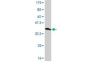 Western Blot detection against Immunogen (36. (IRAK3 Antikörper  (AA 497-596))