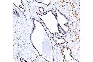 IHC analysis of DDX1 using anti-DDX1 antibody (ABIN7602052).