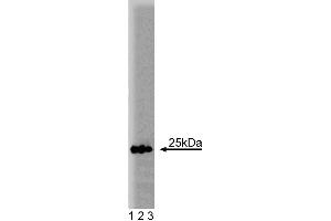 Western blot analysis of Rab5 on a human endothelial cell lysate. (RAB5 Antikörper  (AA 1-215))