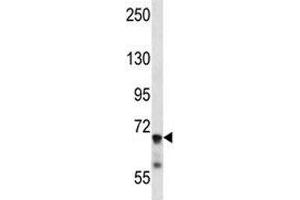 Western Blotting (WB) image for anti-Interleukin 1 Receptor, Type I (IL1R1) (AA 422-450) antibody (ABIN3031430)