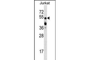 CUGBP2 Antibody (C-term) (ABIN1537389 and ABIN2848868) western blot analysis in Jurkat cell line lysates (35 μg/lane). (CELF2 Antikörper  (C-Term))