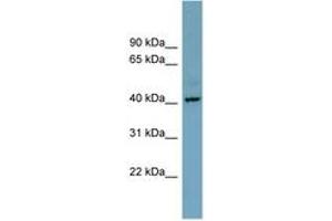 Image no. 1 for anti-Chromosome X Open Reading Frame 66 (CXorf66) (AA 215-264) antibody (ABIN6743320) (CXorf66 Antikörper  (AA 215-264))