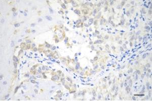 anti-Cyclin-Dependent Kinase 2 (CDK2) antibody