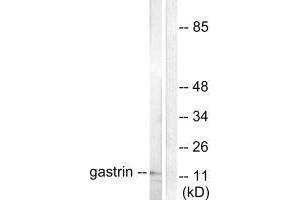 Western blot analysis of extracts from NIH/3T3 cells, using Gastrin antibody. (Gastrin Antikörper)