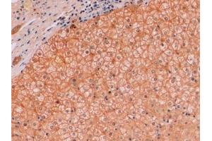 Immunohistochemistry (IHC) image for anti-Catenin, beta (CATNB) (AA 439-675) antibody (ABIN7426154)