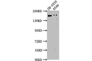 Western Blot Positive WB detected in: SH-SY5Y whole cell lysate, A549 whole cell lysate All lanes: GLI2 antibody at 1:1000 Secondary Goat polyclonal to rabbit IgG at 1/50000 dilution Predicted band size: 168, 134, 132, 89, 87 kDa Observed band size: 168 kDa
