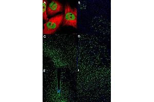 Immunofluorescent staining of U-251 MG (A), mouse midbrain (B), mouse piriform cortex (C), mouse hypothalamus (D, E) and mouse visual cortex (F) with ZNF3 polyclonal antibody  (Green). (ZNF3 Antikörper)